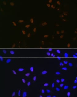 Invitrogen Bub3 Recombinant Rabbit Monoclonal Antibody (10G1S6) 100 &mu;L | Buy Online | Invitrogen&trade; | Fisher Scientific