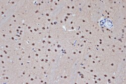 Invitrogen HDAC8 Recombinant Rabbit Monoclonal Antibody (1O2Y5) 100 &mu;L | Buy Online | Invitrogen&trade; | Fisher Scientific