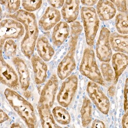 Invitrogen PDK1 Recombinant Rabbit Monoclonal Antibody (5T6S8) 100 &mu;L;
