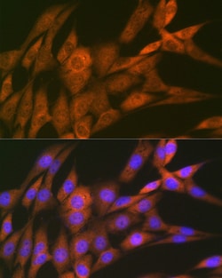 Invitrogen 14-3-3 theta Recombinant Rabbit Monoclonal Antibody (9G6M4)