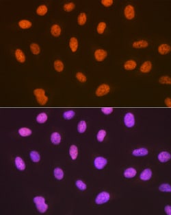 Invitrogen SUMO4 Recombinant Rabbit Monoclonal Antibody (7X3V7) 100 &mu;L;