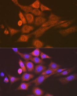 Invitrogen SKP1 Recombinant Rabbit Monoclonal Antibody (10G5X5) 100 &mu;L;