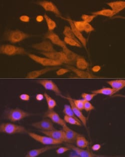 Invitrogen XDH Recombinant Rabbit Monoclonal Antibody (0M8E7) 100 μL;