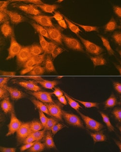Invitrogen PTGER2 Recombinant Rabbit Monoclonal Antibody (2G10L6) 100 &mu;L;