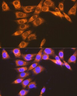 Invitrogen PTGER2 Recombinant Rabbit Monoclonal Antibody (2G10L6) 100 &mu;L;