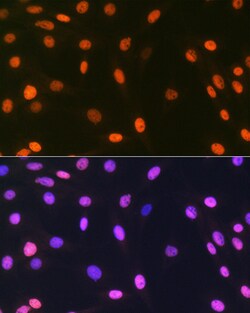 Invitrogen Histone Macro-H2A.1 Recombinant Rabbit Monoclonal Antibody (4D2O4)