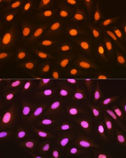 Invitrogen Histone Macro-H2A.1 Recombinant Rabbit Monoclonal Antibody (4D2O4)