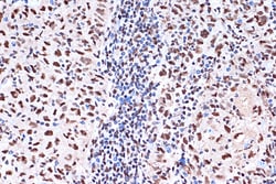 Invitrogen KHSRP Recombinant Rabbit Monoclonal Antibody (4V4O1) 100 &mu;L;