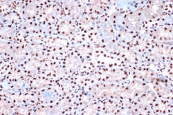 Invitrogen KHSRP Recombinant Rabbit Monoclonal Antibody (4V4O1) 100 &mu;L;
