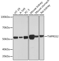 Invitrogen TMPRSS2 Recombinant Rabbit Monoclonal Antibody (7B9W3) 100 &mu;L;