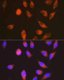 Invitrogen LGR6 Recombinant Rabbit Monoclonal Antibody (8J2J10) 100 &mu;L;