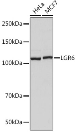 Invitrogen LGR6 Recombinant Rabbit Monoclonal Antibody (8J2J10) 100 &mu;L;