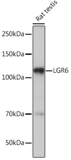 Invitrogen LGR6 Recombinant Rabbit Monoclonal Antibody (8J2J10) 100 &mu;L;