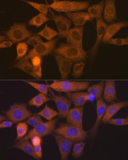 Invitrogen NCK1 Recombinant Rabbit Monoclonal Antibody (4R1N9) 100 &mu;L;