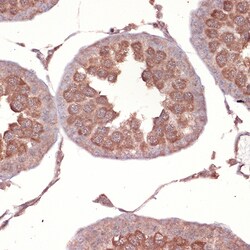 Invitrogen NCK1 Recombinant Rabbit Monoclonal Antibody (4R1N9) 100 &mu;L;