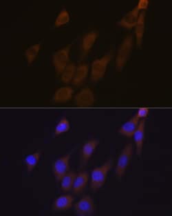 Invitrogen PRDX4 Recombinant Rabbit Monoclonal Antibody (9E7V0) 100 &mu;L;