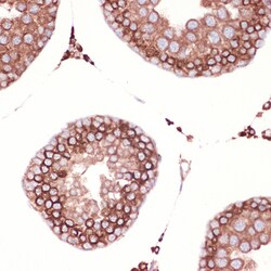 Invitrogen PRDX4 Recombinant Rabbit Monoclonal Antibody (9E7V0) 100 &mu;L;
