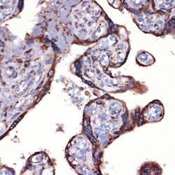 Invitrogen PRDX4 Recombinant Rabbit Monoclonal Antibody (9E7V0) 100 &mu;L;