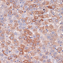 Invitrogen Hemopexin Recombinant Rabbit Monoclonal Antibody (1M6O3) 100