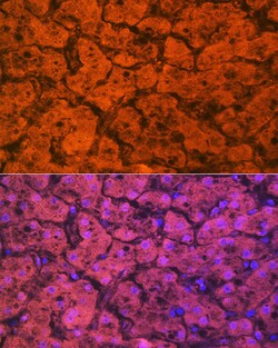 Invitrogen Hemopexin Recombinant Rabbit Monoclonal Antibody (1M6O3) 100
