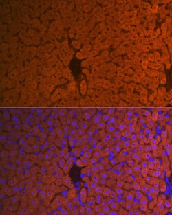 Invitrogen Hemopexin Recombinant Rabbit Monoclonal Antibody (1M6O3) 100