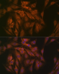 Invitrogen eIF3b Recombinant Rabbit Monoclonal Antibody (4T9V1) 100 &mu;L;
