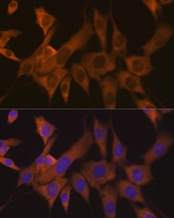 Invitrogen eIF3b Recombinant Rabbit Monoclonal Antibody (4T9V1) 100 &mu;L;
