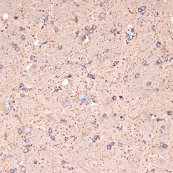 Invitrogen ABAT Recombinant Rabbit Monoclonal Antibody (10V1K9) 100 &mu;L;