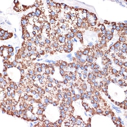 Invitrogen ABAT Recombinant Rabbit Monoclonal Antibody (10V1K9) 100 &mu;L;