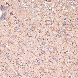 Invitrogen ABAT Recombinant Rabbit Monoclonal Antibody (10V1K9) 100 &mu;L;