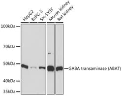 Invitrogen ABAT Recombinant Rabbit Monoclonal Antibody (10V1K9) 100 &mu;L;