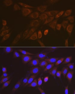 Invitrogen 14-3-3 beta/zeta Recombinant Rabbit Monoclonal Antibody (3J3J9)