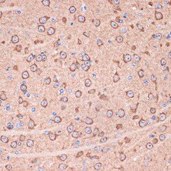 Invitrogen 14-3-3 gamma Recombinant Rabbit Monoclonal Antibody (5R4Q4)