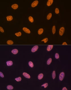 Invitrogen SET Recombinant Rabbit Monoclonal Antibody (8E8M9) 100 &mu;L;