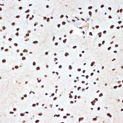 Invitrogen SET Recombinant Rabbit Monoclonal Antibody (8E8M9) 100 &mu;L;