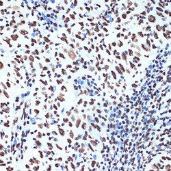 Invitrogen SET Recombinant Rabbit Monoclonal Antibody (8E8M9) 100 &mu;L;
