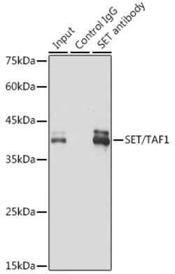 Invitrogen SET Recombinant Rabbit Monoclonal Antibody (8E8M9) 100 &mu;L;