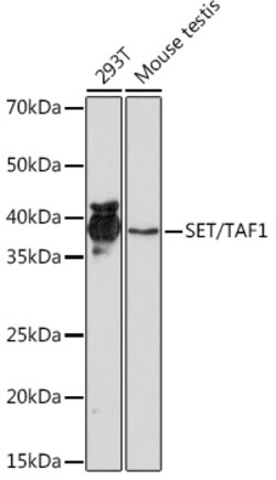 Invitrogen SET Recombinant Rabbit Monoclonal Antibody (8E8M9) 100 &mu;L;