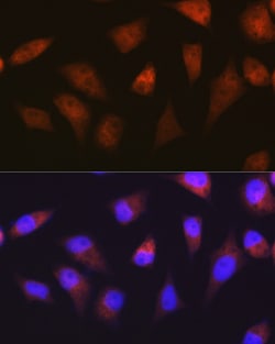 Invitrogen PSMA2 Recombinant Rabbit Monoclonal Antibody (6L5H4) 100 &mu;L;