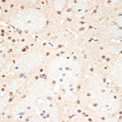 Invitrogen PSMA2 Recombinant Rabbit Monoclonal Antibody (6L5H4) 100 &mu;L;