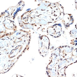 Invitrogen PSMA2 Recombinant Rabbit Monoclonal Antibody (6L5H4) 100 &mu;L;