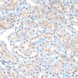 Invitrogen PSMA2 Recombinant Rabbit Monoclonal Antibody (6L5H4) 100 &mu;L;