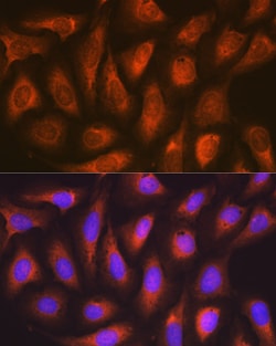 Invitrogen SOCS2 Recombinant Rabbit Monoclonal Antibody (6D3F6) 100 &mu;L;