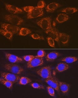 Invitrogen ARF1 Recombinant Rabbit Monoclonal Antibody (0C5B3) 100 μL;