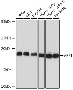 Invitrogen ARF1 Recombinant Rabbit Monoclonal Antibody (0C5B3) 100 μL;