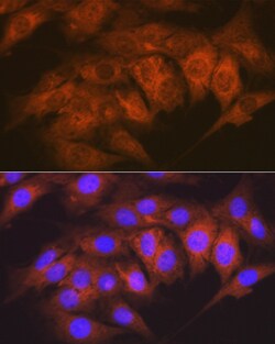 Invitrogen CaMKII delta Recombinant Rabbit Monoclonal Antibody (10M1P2)