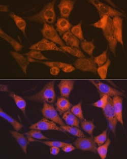 Invitrogen CaMKII delta Recombinant Rabbit Monoclonal Antibody (10M1P2)