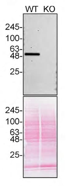 Invitrogen CaMKII delta Recombinant Rabbit Monoclonal Antibody (10M1P2)
