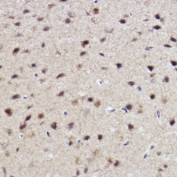 Invitrogen ABH1 Recombinant Rabbit Monoclonal Antibody (5K4W5) 100 &mu;L;