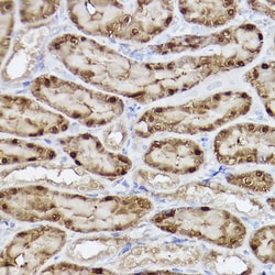 Invitrogen ABH1 Recombinant Rabbit Monoclonal Antibody (5K4W5) 100 &mu;L;